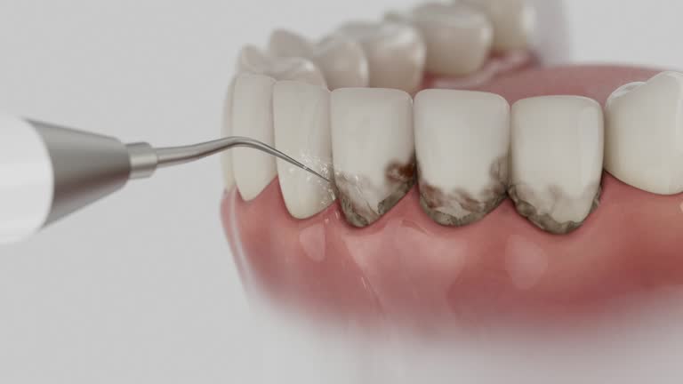 Reliable Dental contractor in Tavernier, FL by Smile Center Dentistry